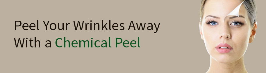 Chemical peels